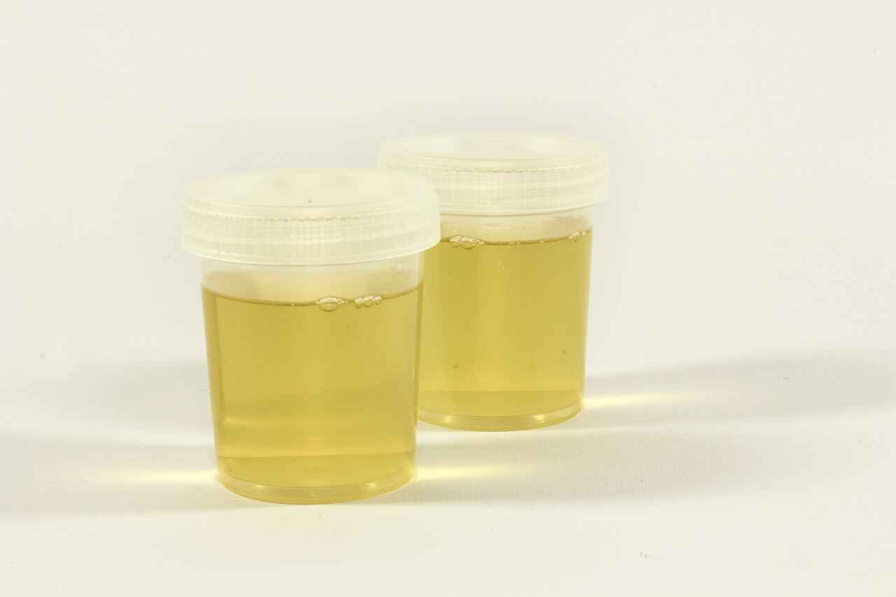 Wilmington Substance Use Disorders: Urine Testing